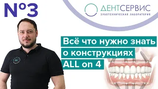 Обзор ортопедических конструкций All on 4 (Всё на 4)