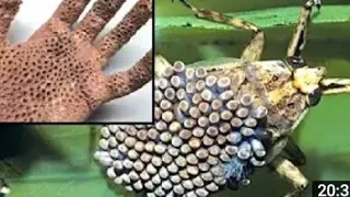 15 Most Dangerous/ bugs/ invertebrates in the world