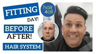 Before & After | Hair System | Non-Surgical Hair Replacement System for Men/Women