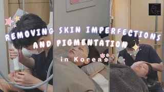 Removing Skin Imperfections & Pigmentation