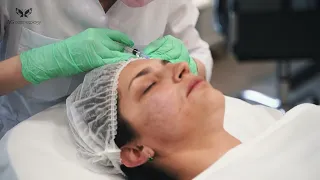 Бюджетная, но действенная мезотерапия Dermaheal HSR