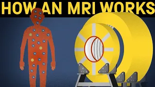 How does an MRI machine work?