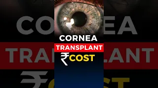 Cornea Transplant Cost