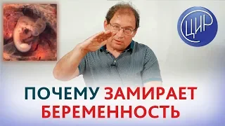 Причины замершей беременности. Почему происходит остановка развития беременности. Гузов И.И.