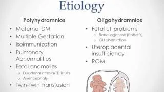 Polyhydramnios and Oligohydramnios - USMLE Step 2 Review
