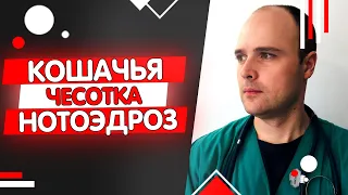 Кошачья чесотка или нотоэдроз кошек