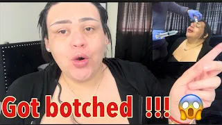 Did my lips and nose got botched !!!  Vlog