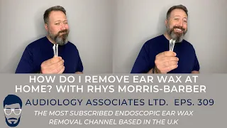 HOW DO I REMOVE EAR WAX AT HOME - EP 309