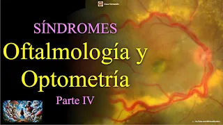 Clase de Síndromes en Oftalmología y Optometría, Parte IV