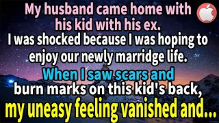 My husband came home with his kid with his ex. His daughter had scars and burn marks on her back...