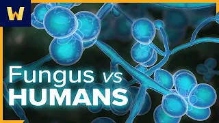 What Is Fungus and How Do Fungal Infections Happen? | An Introduction to Infectious Diseases