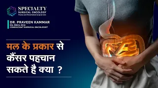 मल के प्रकार से  कैंसर पहचान सकते है क्या ? | Can cancer be detected in stool? | Dr Praveen Kammar