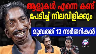 എനിക്ക് ഒരു കല്ല്യാണം കഴിക്കണം..!! | ABC TV