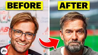 Why Jurgen Klopp Is Burnt-Out.