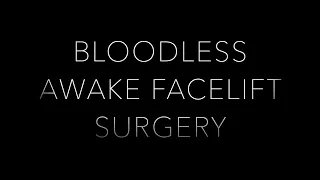 Bloodless Awake Facelift Surgery | Local Anesthesia | Dr. Kenneth Kim Plastic Surgery