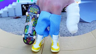 FINGER SKATEBOARD | OMG I GOT INJURED | Wheel Chair Tricks | Tech Deck | Fingerboarding