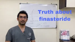 Finasteride Tablet Truth (Finasteride टैबलेट के बारे में सच्चाई) | Finasteride Tablet For Hair Loss