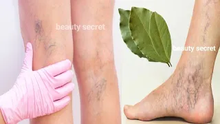 Say goodbye to varicose veins and joint pain with this single leaf of grass, effective 100%