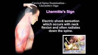 Cervical Spine Examination, Lhermitte's Sign - Everything You Need To Know - Dr. Nabil Ebraheim