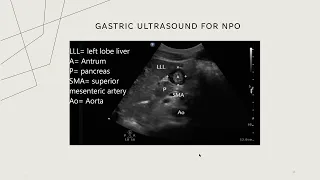 Ultrasound in Anesthesiology and Perioperative Anesthesia