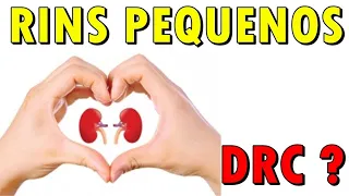 RINS Pequenos INDICAM DRC ? | Cortes Renais Ep. 56