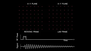 MRI: Physics and Image Creation - Spin Lattice Relaxation (Part 7/18)