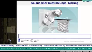 Matthias Guckenberger: Prostatakarzinom - Moderne Strahlentherapie