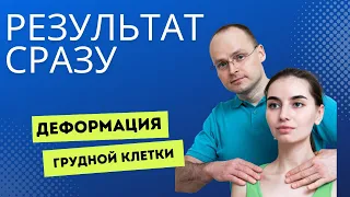 Воронкообразная грудная клетка. Лечение методом P-DTR: демонстрация и объяснение принципов работы