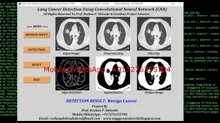 Lung Cancer Detection Using (CNN) Convolutional Neural Network Python OpenCV Tensorflow Project Code