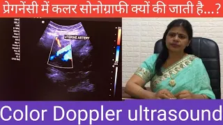 Color Doppler ultrasound pregnancy /प्रेगनेंसी में कलर सोनोग्राफी क्यों और कब की जाती है?