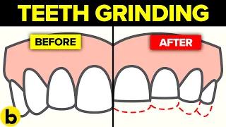 Here’s What Happens When You Grind Your Teeth At Night