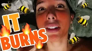 I Tried The BEE VENOM FACIAL 🐝| Mar