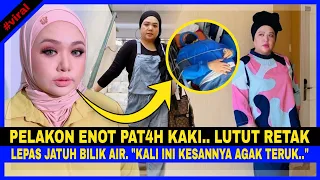 Pelakon Enot PATÂH KAKI..LUTUT RETÂK, JÂTUH Bilik Air. "Kali Ini KESANNYA Agak TERŮK.."