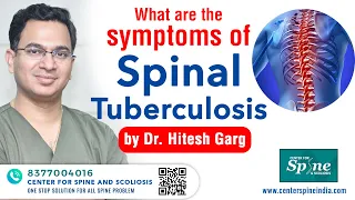 Symptoms of Spinal Tuberculosis (SPINE TB) / Pott's disease - Dr. Hitesh Garg - Spine Surgeon India