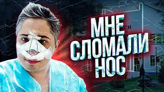 КИВАЧ. Мне СЛОМАЛИ НОС. Трансформация