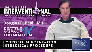 Hydrogel Augmentation Intradiscal Procedure - Douglas P. Beall, M.D.