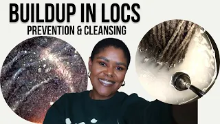 Loc Buildup: How to Prevent + Clean Lint, Product, Dandruff | Loctician Advice