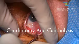 Canthotomy and Cantholysis: For Emergency Orbital Compartment Syndrome or Routine Eyelid Surgery