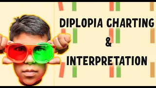 Diplopia Charting and Interpretation: A Step-by-Step Guide for Ophthalmologists and optometrists.