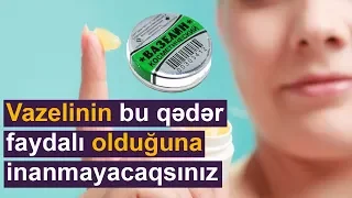 Vazelinin 21 bilmədiyiniz faydası