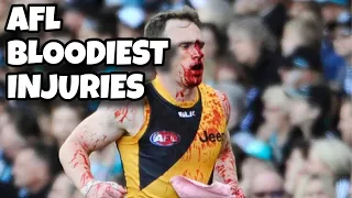 AFL “BLOODIEST” INJURIES