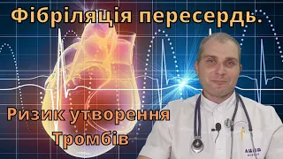 Аритмія. Ризик утворення тромбів після ковіду. Фібриляція передсердь