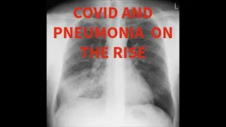 Thursday's Pandemic Update: Covid And Mysterious Pneumonia Cases On The Rise