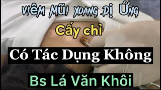 Viêm xoang mũi dị ứng cấy chỉ có tác dụng không | Bác sĩ Lá Văn Khôi