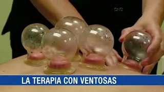 Conozca los secretos de la antigua terapia china que Michael Phelps puso de moda