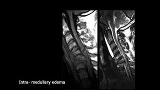 Dr Mamdouh Mahfouz Spinal imaging spinal trauma