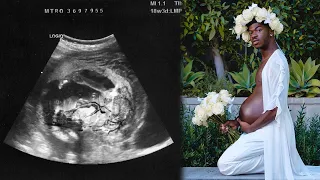 Lil Nas X Is PREGNANT?!