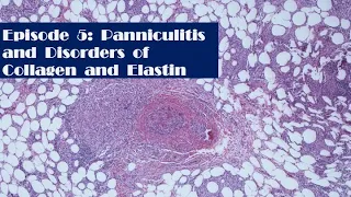 Episode 5: Panniculitis and Disorders of collagen and elastin