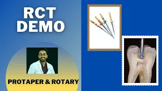 RCT DEMO USING HAND PROTAPER AND ROTARY FILES