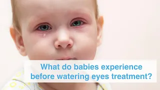 What do babies experience before watering eyes treatment?